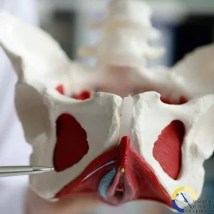 Anatomical pelvis model highlighting red and white area for Emsella Treatment